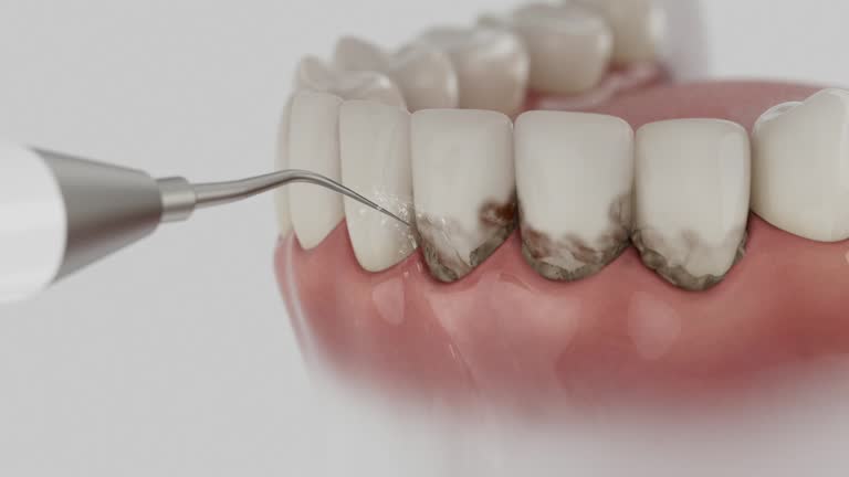 Trusted Teeth Cleaning And Checkup service in Linntown, PA - Dentist Open Now